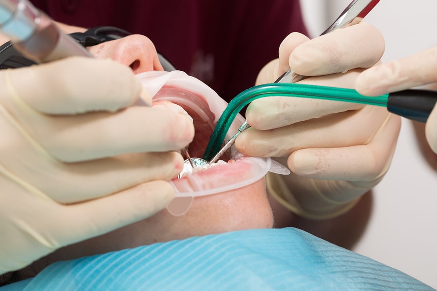 Zahnarzthaftung bei Nervenschädigung und mangelhafter Aufklärung