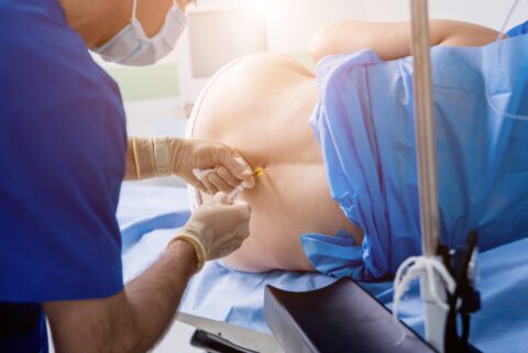Arzt- bzw. Krankenhaushaftung - Schädigung durch Spinalanästhesie