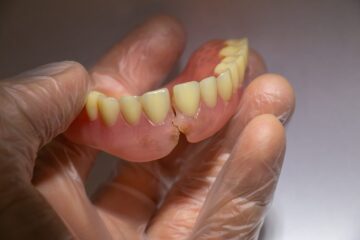 Zahnarzthaftung – Schadenersatzanspruch aufgrund Zahnersatzfraktur