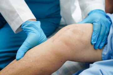 Behandlungsfehler – Einsetzen einer Knie-Totalendoprothese – alternative Behandlungsmethoden